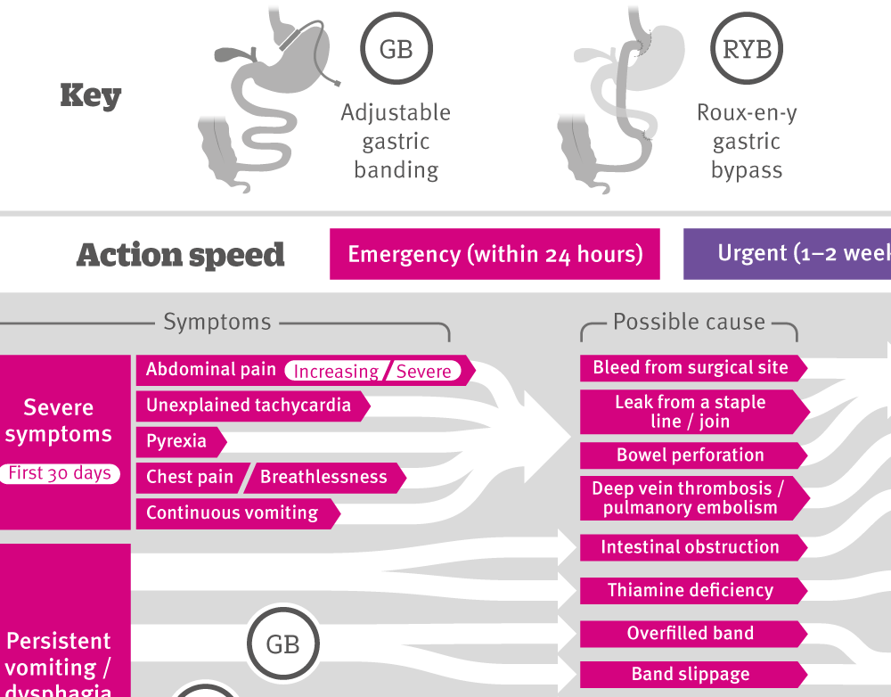 Complications of weight loss surgery