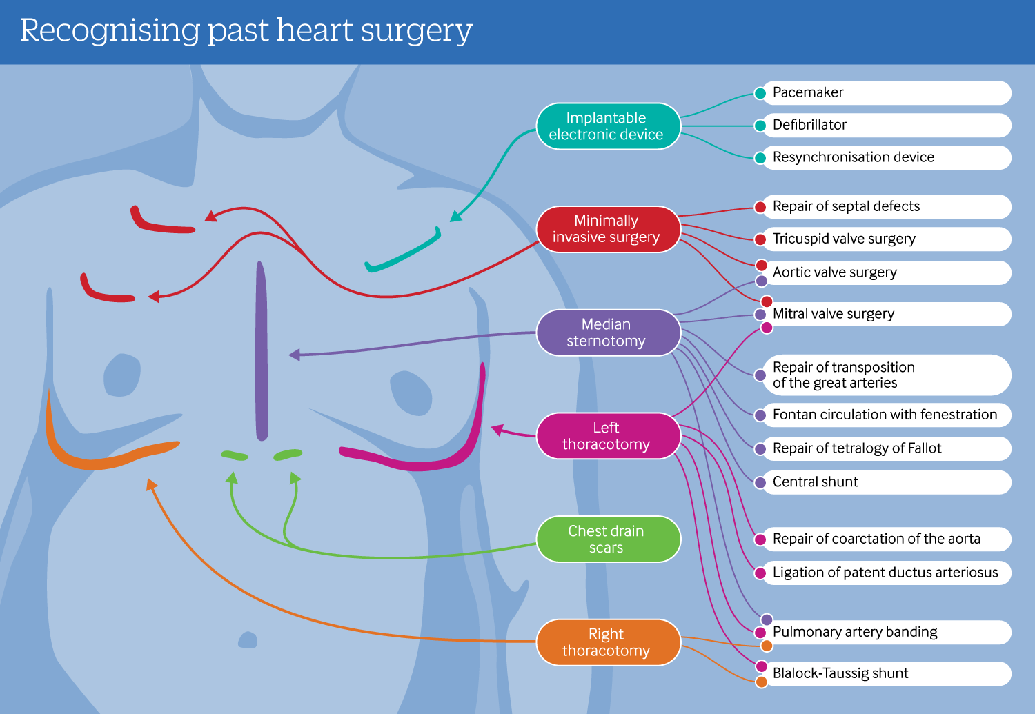 infographic showing six different chest scars, and the related surgical techniques.