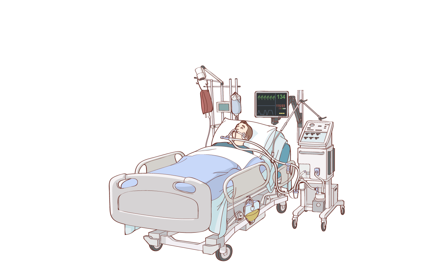 illustration of man in intensive care unit with ventilator, feeding tube, IV drip and urinary catheter